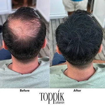 Toppik Hair Fibers لفراغات الشعر